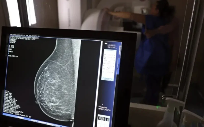 Ministério da Saúde passa a recomendar mamografia a partir dos 40 anos